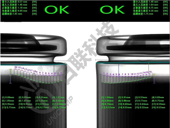 X-ray設備 X-ray設備